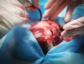 Premium-Photo-Doctor-doing-heart-operation-transformed